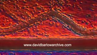 Inflammatory Response in Tissue 1