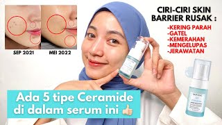 KUPAS TUNTAS! SKINTIFIC 5X CERAMIDE REPAIR BARRIER SERUM - SERUM UNTUK MEMPERBAIKI SKIN BARRIER