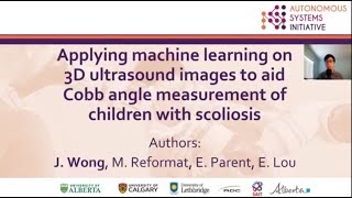 Applying machine learning on 3D ultrasound images to aid Cobb angle measurement  in scoliosis