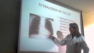 Abordaje Del Niño Con Sospecha De Cardiopatía Parte 2