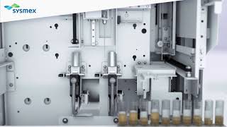 UN Series   Intelligent urinalysis workflow