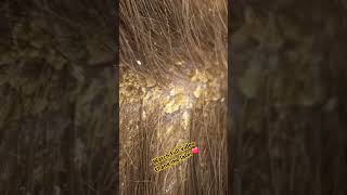 Dandruf ka hal #haircare #longhair #hairoil #ytshortsvideo