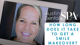 How Long Does it Take for a Smile Makeover? | Austin Dental Spa | Austin, TX | Ph: 512-452-9296