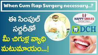 When Gum Surgery Needed || Flap Surgery || Treatment For Gum Disease || Dr Chandra Shekar Alladi