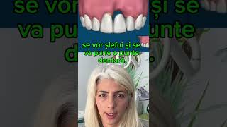 Implant versus puntea protetica.#cluj #maradent #dentist #clujlife #lifehacks #implantdentar#life