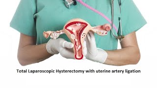 Total Laparoscopic Hysterectomy with uterine artery ligation by Dr Meena Naik