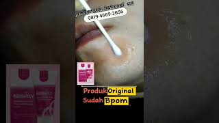 salep khusus kutil #fypage #skincare #trendingtopicsonyoutube #fypyoutube