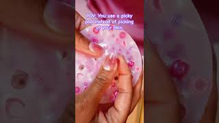 Have you tried a picky pad? #pickypad #oddlysatisfying #relaxingasmr #skinpicking