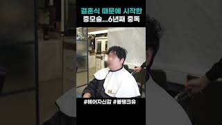 울산에서 분당까지 N년째 탈모 시술받고 있습니다