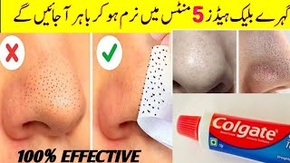 How To Remove BLACKHEADS Permanently From Nose & Face | Instant Whitehead Removal at Home Naturally