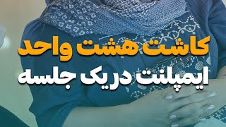 کاشت هشت واحد ایمپلنت در یک جلسه بدون درد برای مراجعه کننده عزیزمون 😊