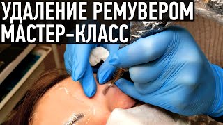 Удаление татуажа ремувером - мастер-класс от Ирины Ткачук