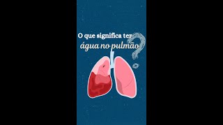 Você sabe o que é o derrame pleural? O que significa ter água no pulmão?