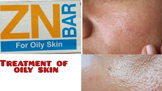 zn bar benefits and uses in urdu/hindi||oily skin treatment||best soap for oily skin