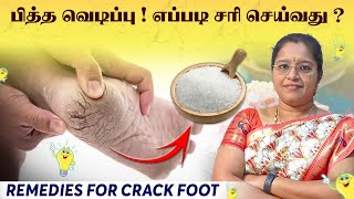 பித்த வெடிப்பு ! எப்படி சரி செய்வது ? Remedies For Crack Foot | Dr A.VENI |Trichy