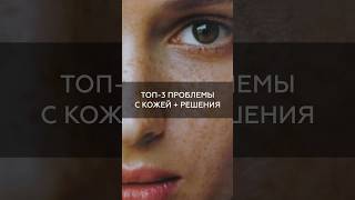 Топ-3 проблемы с кожей + решения #shorts #short #cosmetics #косметика #пигментация #черныеточки