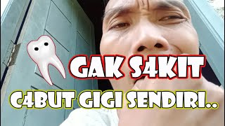 CARA MENC4BUT GIGI YANG GOYANG TANPA RASA S4KIT