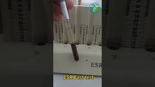 ESR | Erythrocytes Sedimentation rate | High ESR level | ESR blood test | esr test | wintrobe method