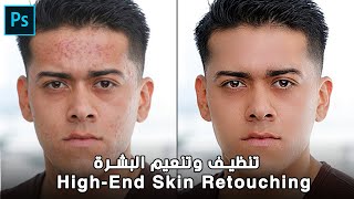 تنظيف وتنعيم البشرة فى الفوتوشوب - High-End Skin Retouching in Photoshop