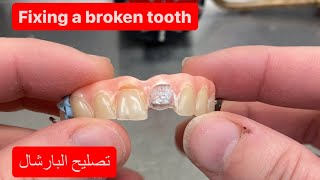 REPAIRING A CAST METAL PARTIAL DENTURE