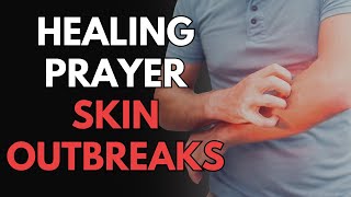 Healing Prayer - Skin Outbreaks | Prayer for rosacea, psoriasis, acne and eczema, and liver