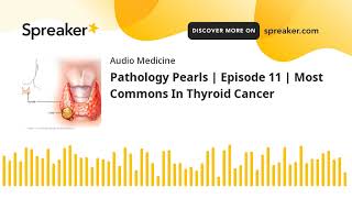 Fast Facts In Thyroid Cancer in Less than 2 Minutes!