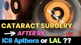 IC-8 Apthera vs Light Adjustable Lens (LAL) | Which implant is better for Cataract Surgery after RK?