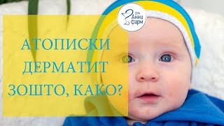 АТОПИСКИ ДЕРМАТИТ ЗОШТО, КАКО СО ДР. ИРИНА АРСОВСКА БЕЖОСКА