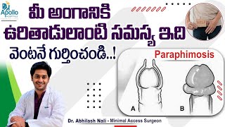 అంగంపై చర్మం ఉబ్బిందా? || Paraphimosis Symptoms and Treatment in Telugu || Dr Abhilash Nali