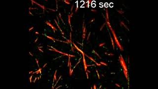 Leaf cell expressing reporters for microtubules (red) and cellulose synthases