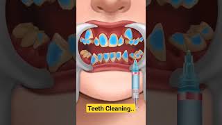 Mouth & Teeth Cleaning. #medicalstudent #bscnursing #medical2024 #viralshorts