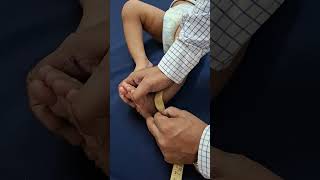 H#ow to take measurement of lower limbs in Genu varus / Varum or Genu Valgus / Valgum) deformity.