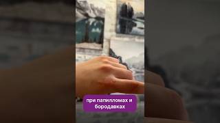 Выжигаем папилломы навсегда! Артикул ВБ - 144626993 🌹