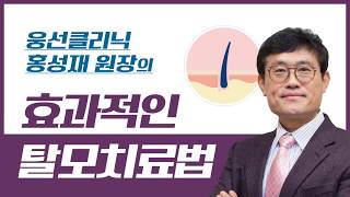 [홍성재 원장] 효과적인 탈모치료법