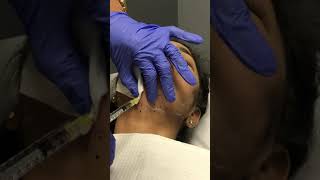 Kybella injections with Dr. Usha Mantha Weight Loss & Laser Aesthetic Medical Spa