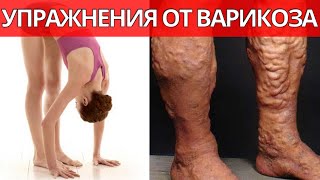 Гимнастика от варикоза. Чем опасен коронавирус.