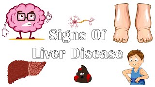 Six Signs Of Liver Disease - What Are The Signs & Symptoms Indicate That You Have Liver Disease