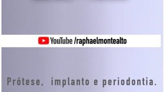 Implantes em área estética