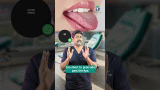 பெருநாக்கு சிறு நாக்கு - Macroglossia Microglossia | Dr. Karthikeyan | Denta Kings #shorts