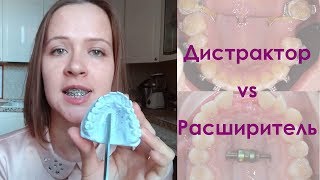 Расширение верхней челюсти. Дистрактор и расширитель