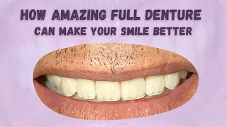 WDC_HOW AMAZING FULL DENTURE CAN MAKE YOUR SMILE BETTER | FULL EDENTULOUS | GIGI TIRUAN LENGKAP