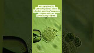 Fertilization of a human oocyte by the ICSI method Запліднення ооциту людини методом ICSI #icsi #ivf