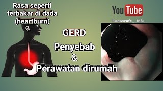 GERD dan Perawatan di rumah