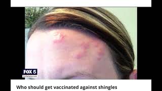 @fox5atlanta Shingles and vaccinations