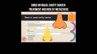 Sinus or nasal cavity cancer: treatment and risk of metastasis #sinushealth #nasalcavity #cancer