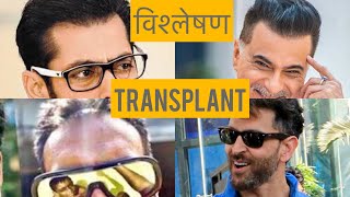 बॉलीवुड|BOLLYWOOD BEST HAIR TRANSPLANT RESULTS| Hairfall| Hairloss| Minoxidil Finasteride| hindi