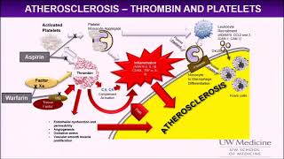 Combined Antiplatelets and Anticoagulants for Atherosclerosis: Insights from the COMPASS Study