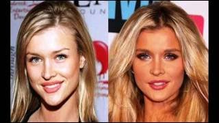 Joanna krupa plastic surgery before and after