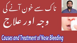 Nakseer ya naak se khoon ane ki waja aur ilaj / how to stop Nose bleeding or Epistaxis in Urdu