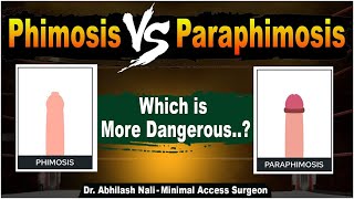 Phimosis vs Paraphimosis | Difference Between Phimosis and Paraphimosis in Telugu | Dr Abhilash Nali